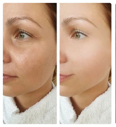 Retinol Serum-Anti Ageing